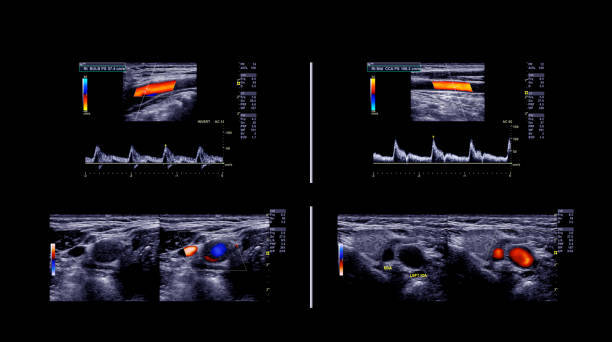 private ultrasound