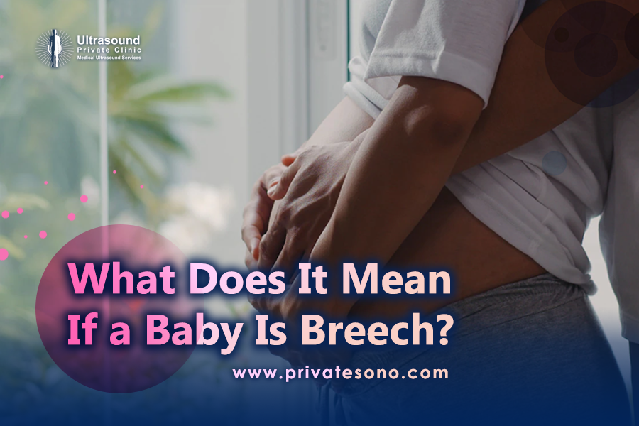 What Does It Mean if a Baby is Breech?