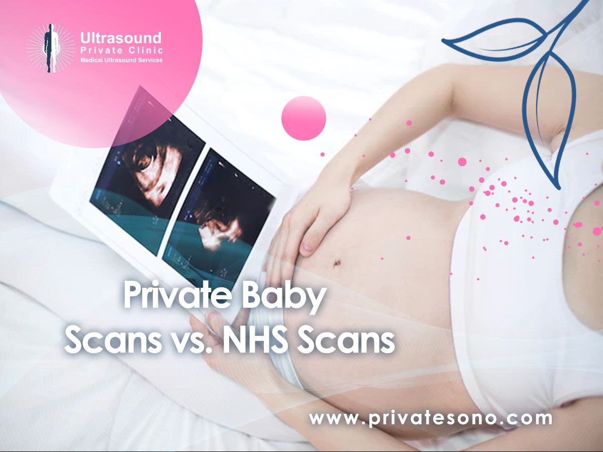 Private Baby Scans vs. NHS Scans