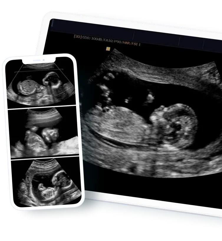 ultrasound scan