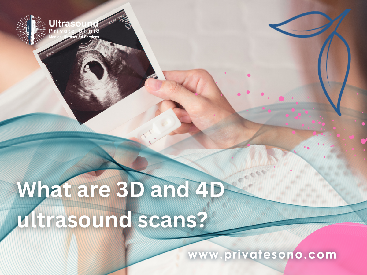 What are 3D and 4D ultrasound scans?