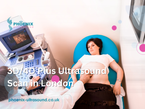3D/4D Plus Ultrasound Scan in London
