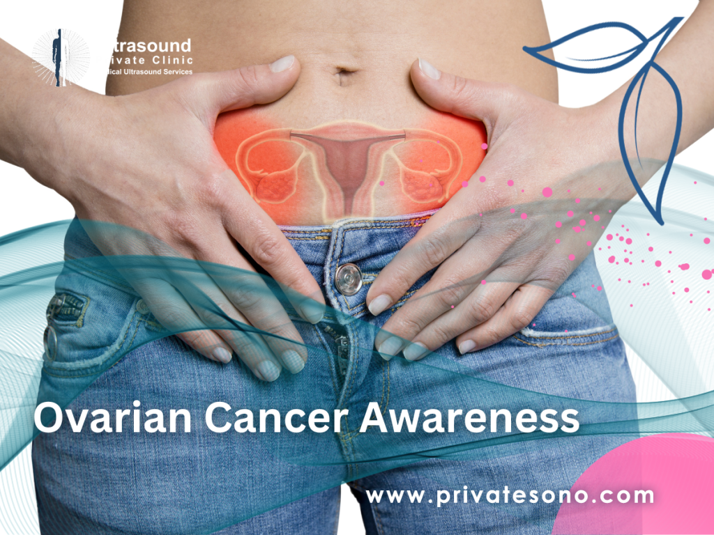 Ovarian Cancer Awareness