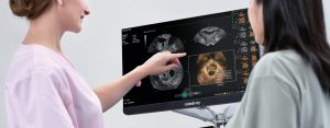 Medical Ultrasound Scan
