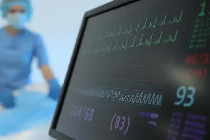 ECG
