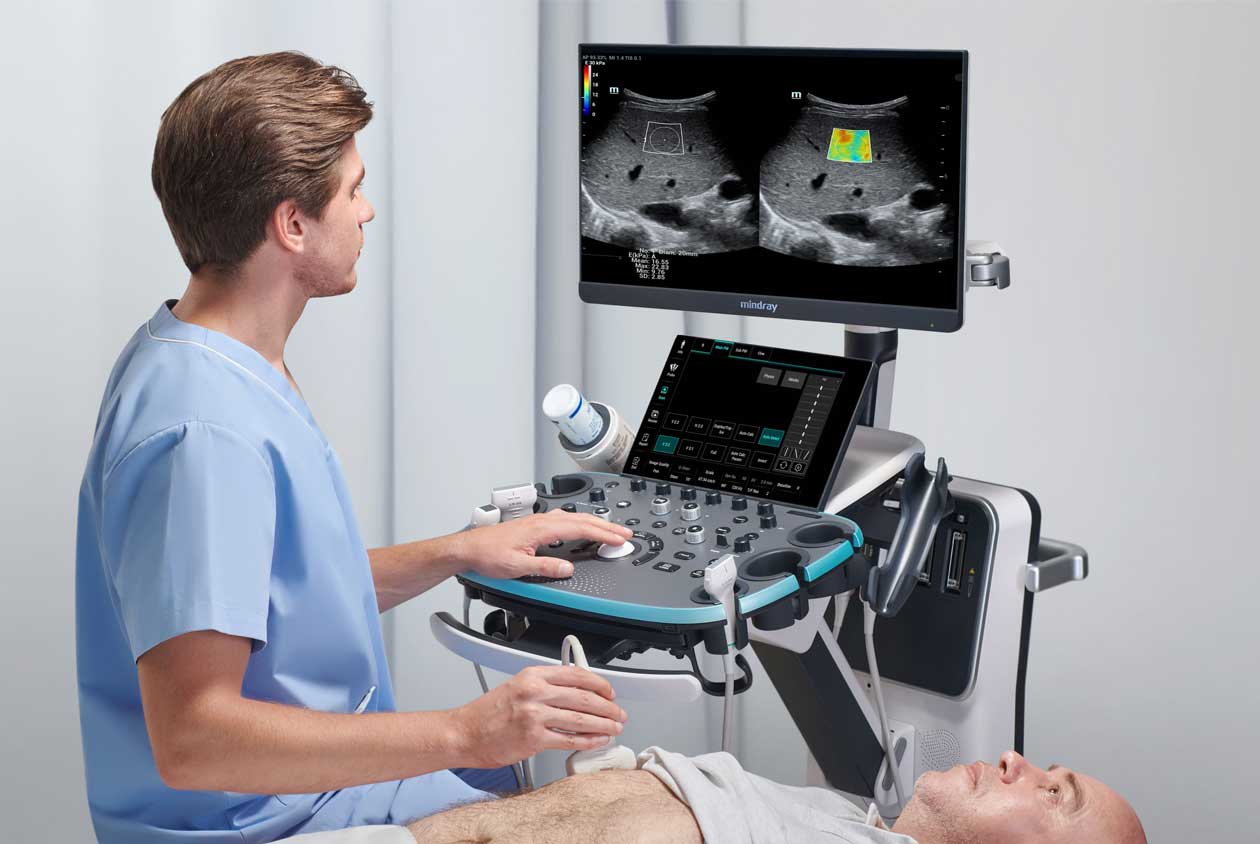 Liver FibroScan