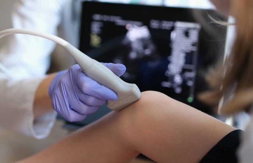 knee ultrasound scan