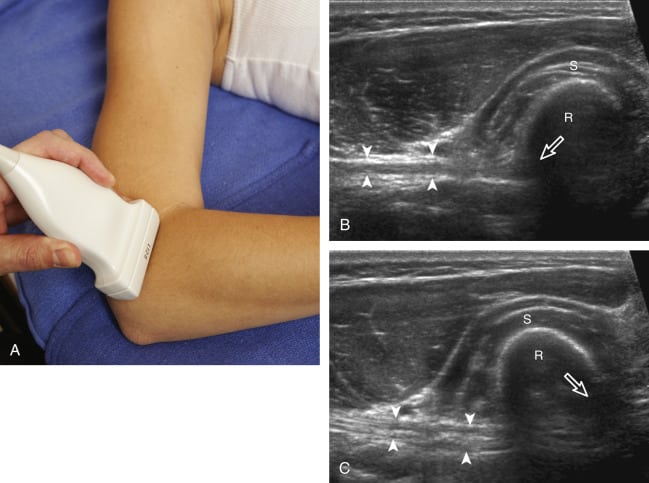 elbow ultrasound