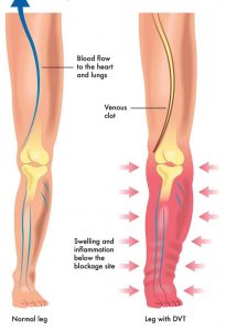 service-dvt DVT scan